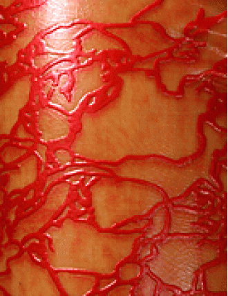 Struktur Latex Red Moire